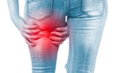 坐骨神経痛の画像